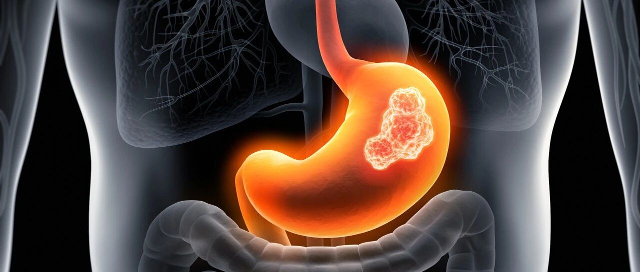 《人世间》大结局：周秉义胃癌离世…胃癌早期症状，中了这几点，尽早检查！