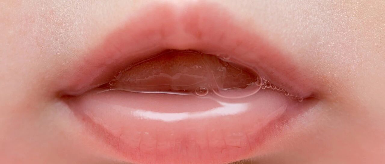 从小听到大！"万能唾液"也能消毒？当心伤口感染，有人因此截指…