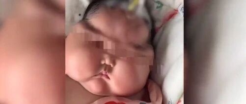 冲上热搜！婴儿使用抑菌霜后成"大头娃娃"？这些事你一定要知道…