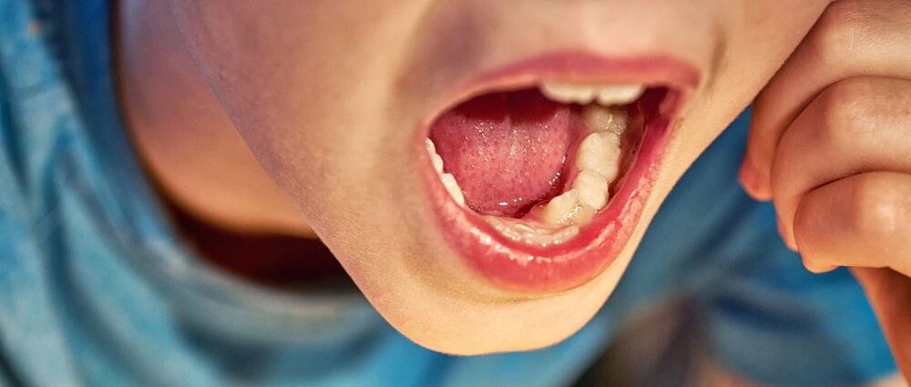 嚼东西就疼，一张嘴大了还发出咔咔声？别不当回事！这是病，得治！