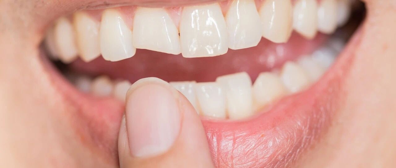 女子磨牙，常喝碳酸饮料门牙被磨没：磨牙是种病，该引起重视了！