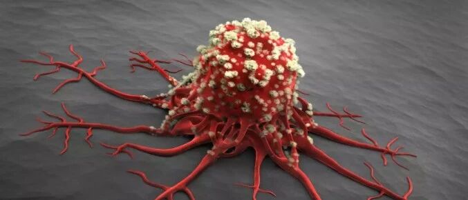 癌症会遗传吗？肿瘤专家：肯定的！这5种癌症最容易遗传！