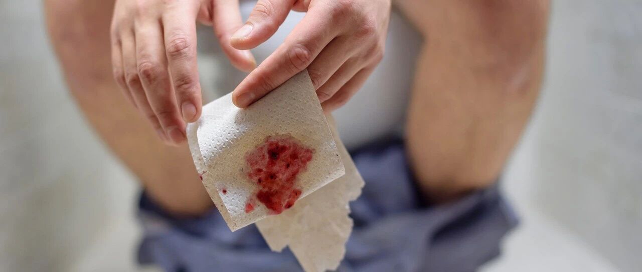 屁股擦不对，痔疮找上门？痔疮到底怎么预防？不知道的看这里