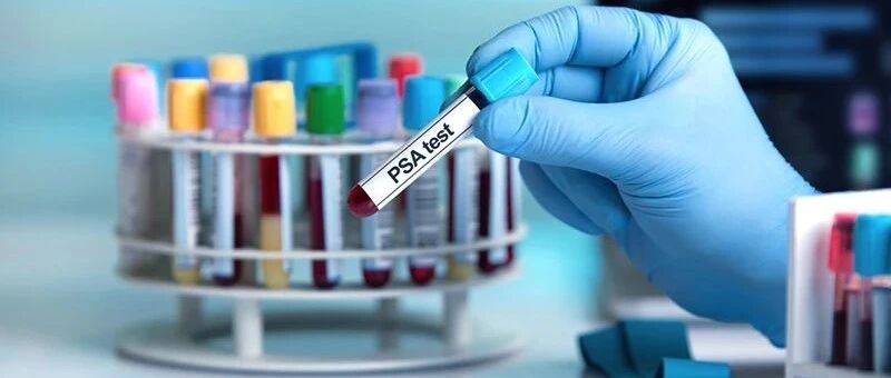 肿瘤标志物升高，就是患癌了吗？有这种情况的，一定要引起重视…