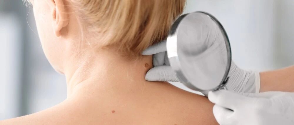 千万别大意！这些地方长"小疙瘩"，可能诱发癌变…