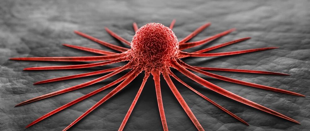 当心！这些肿瘤与"吃"密切相关，看完一定要避开…