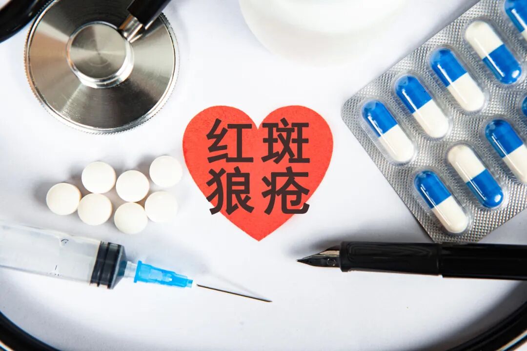 红斑狼疮是怎么引起的