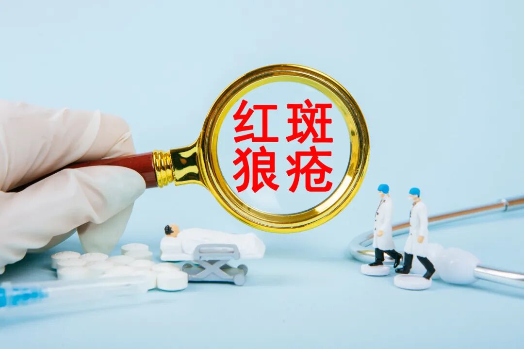 红斑狼疮是怎么引起的