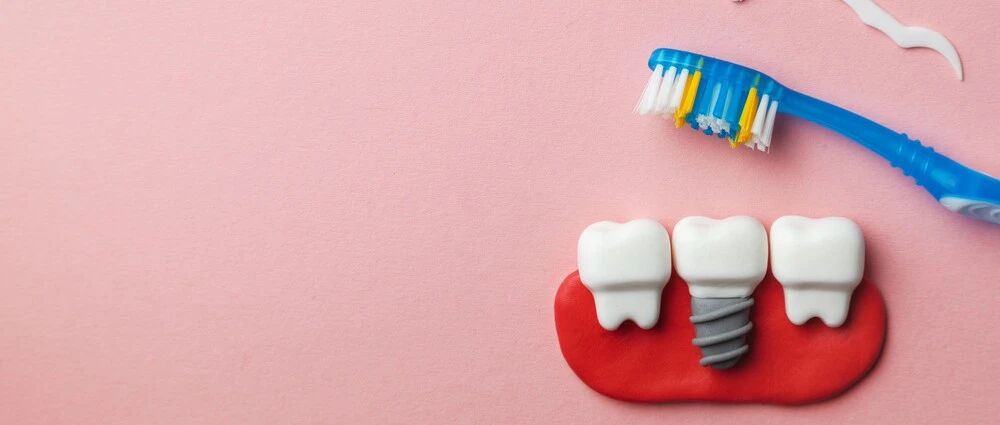 "种牙自由"不远了？种植牙将纳入集采！你想知道的都在这里