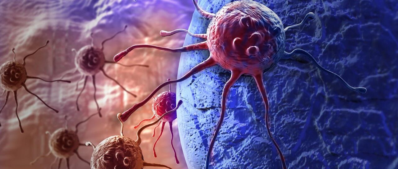 警惕！女子才30岁被确诊肠癌，医生：这两个习惯太致命…