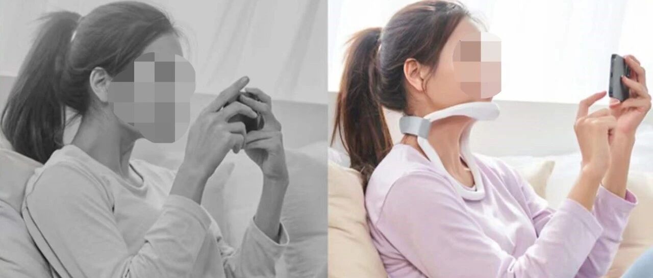 "防低头神器"火了！能改善脖子前倾、预防驼背？这些潜在危害一定要知道…