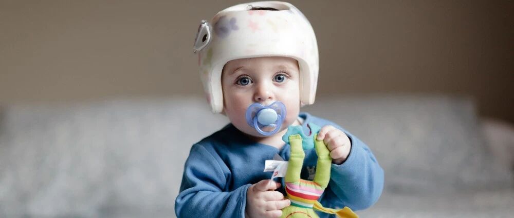 2.8万元矫正型"头盔"遭疯抢，只为圆头！究竟是不是智商税？看完秒懂…