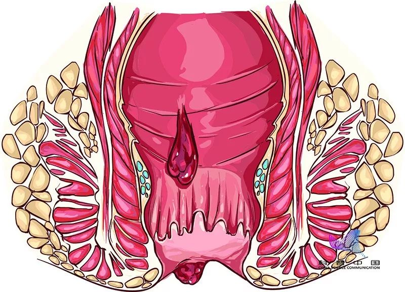 肛管粘膜图片