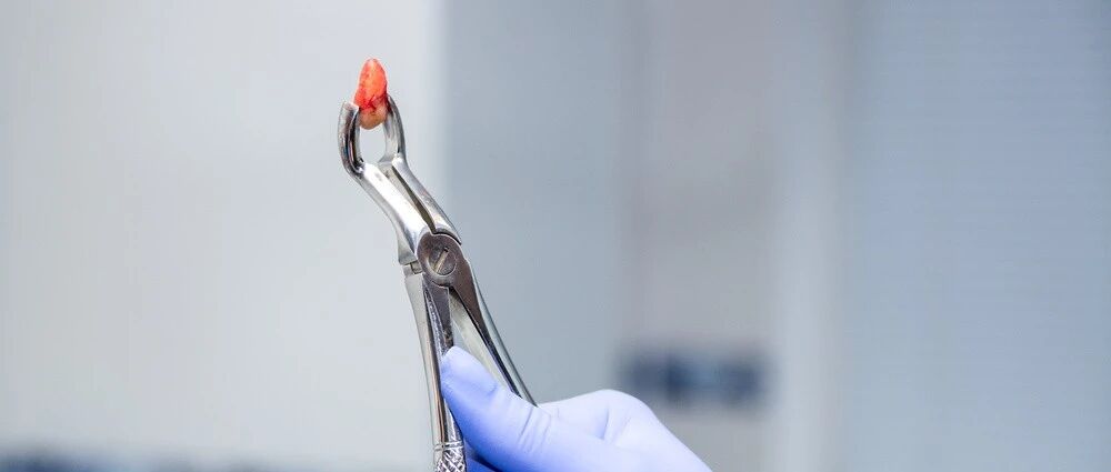 5岁女童拔牙，大出血脑死亡！拔牙前一定要知道的事项，不要不当回事！