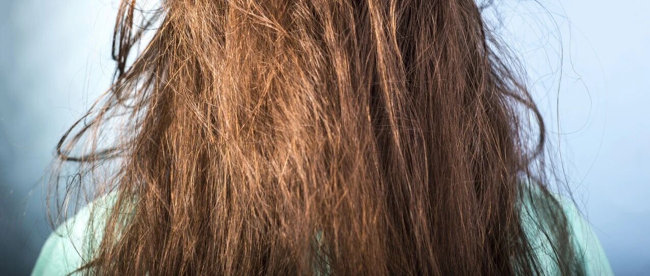 太糟心！天天洗头，头发却越洗越油？多久洗一次最好？原来这些年都错了…