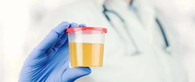 注意！上完厕所最好看一眼，尿液出现这几种颜色要当心了！