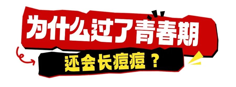 痘痘怎么治疗