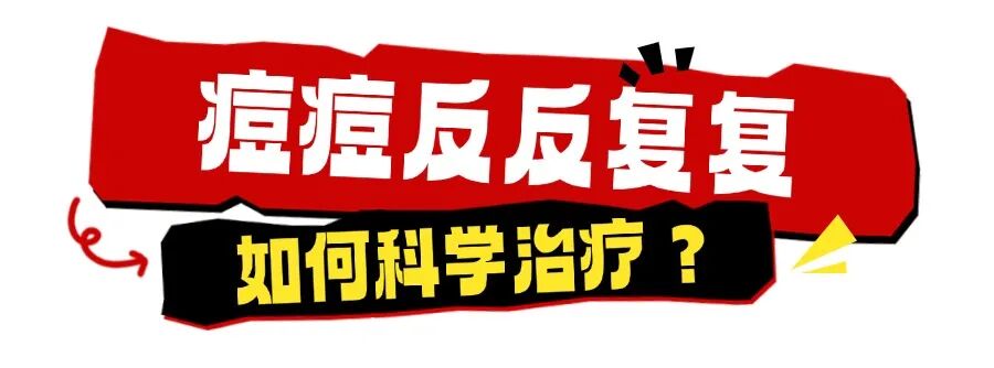 痘痘怎么治疗
