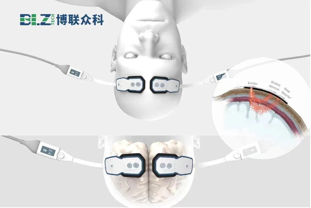 新生儿电极片怎么贴脑氧饱和度监测在小儿先天性心脏病术后的临床应用_https://www.jmylbn.com_新闻资讯_第3张