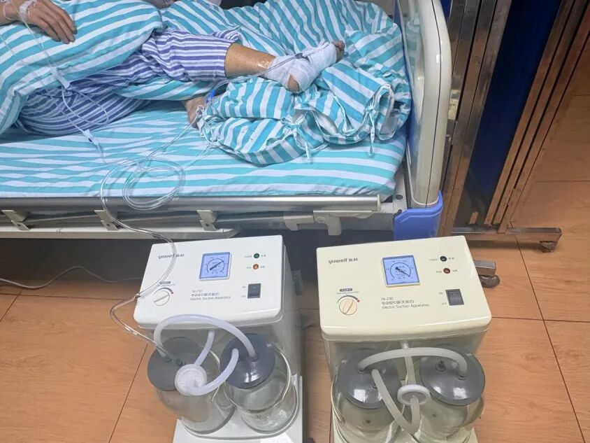 vsd引流器怎么连接【健康科普】负压封闭引流术--伤口的“高级吸尘器”，让伤口愈合更轻松_https://www.jmylbn.com_新闻资讯_第5张