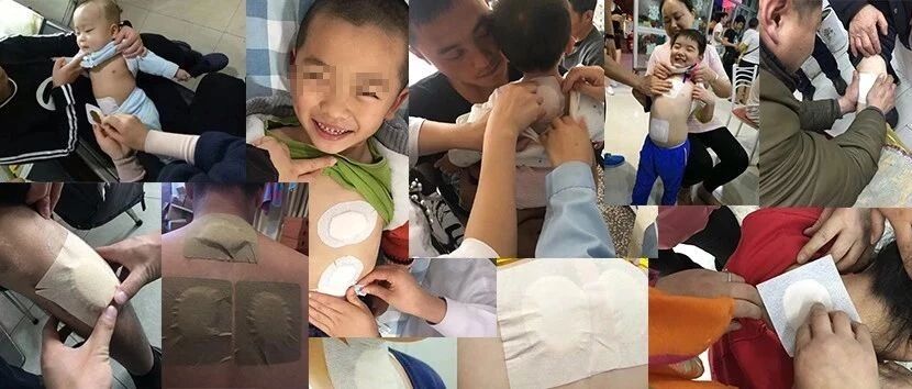 “三九贴” —— 冬日里的身体保护伞！