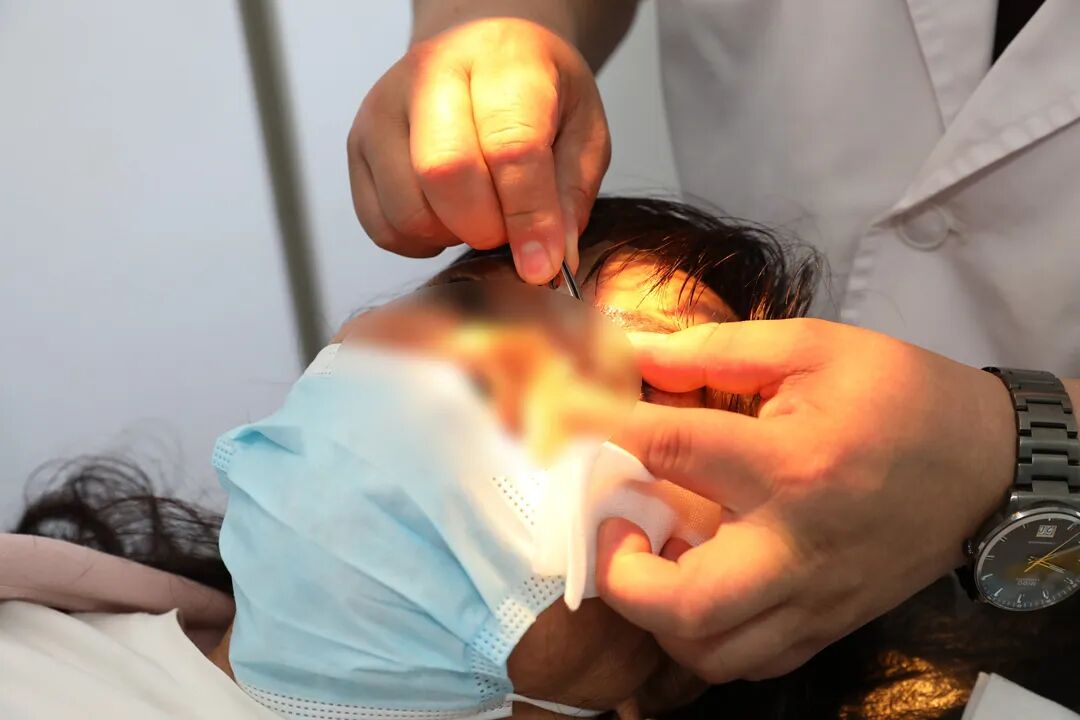 超声雾化器治疗什么病【医疗技术】北大荒集团九三医院眼部超声雾化器精准治疗干眼症_https://www.jmylbn.com_新闻资讯_第9张