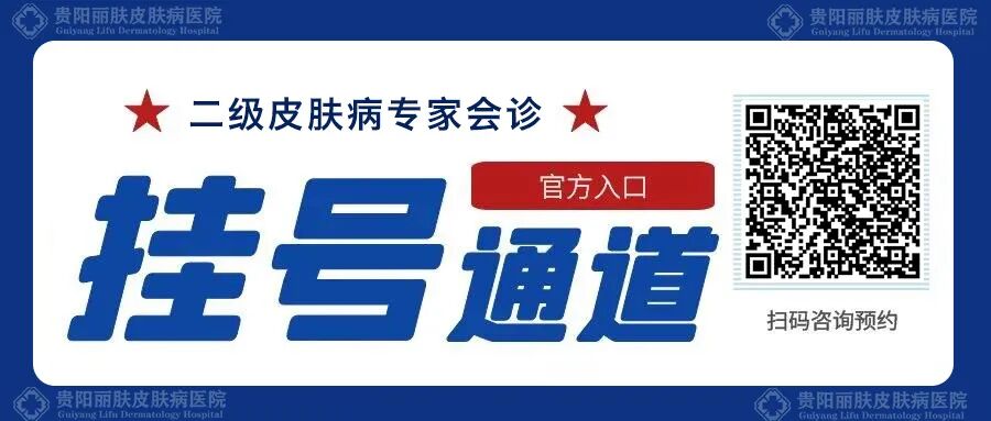 脂溢性皮炎反复发作？怎么治疗才好？