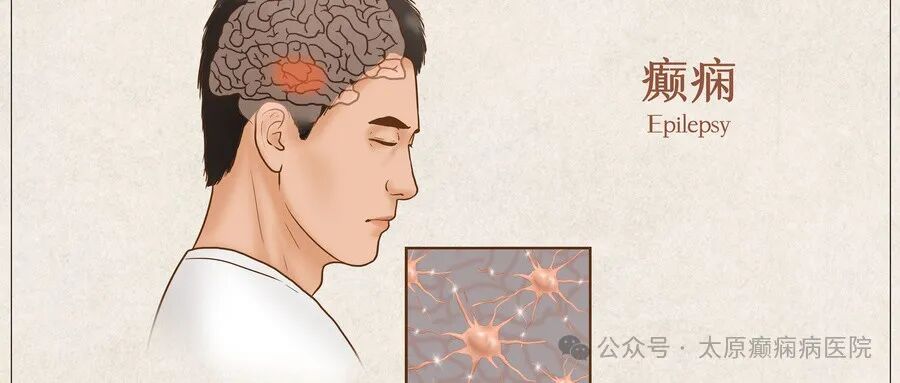 动态脑电图怎么看动态脑电图能查什么？你都知道吗？_https://www.jmylbn.com_新闻资讯_第5张