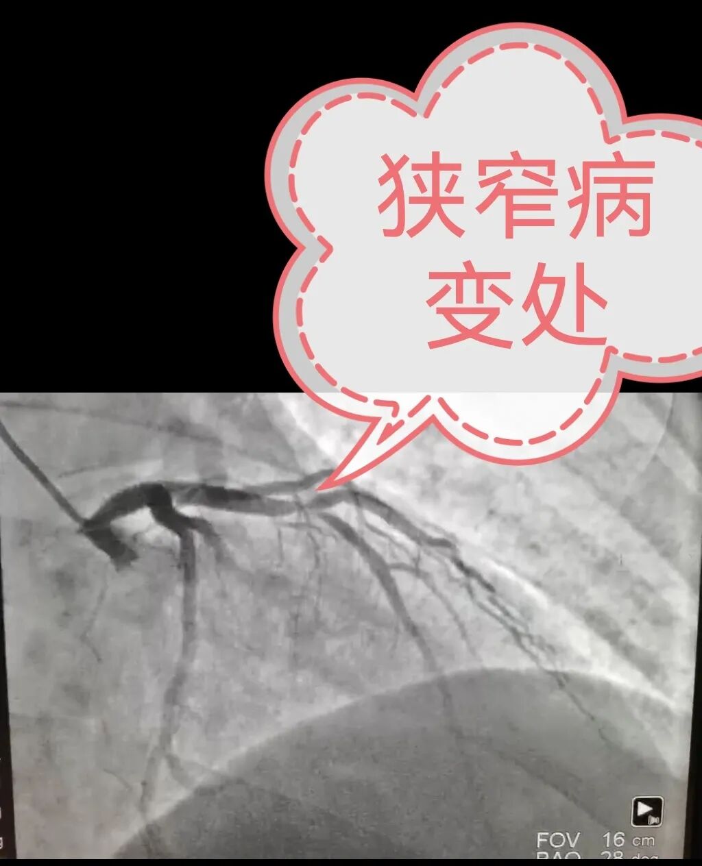 心电图机平板怎么使用在“跑步机”上也能诊断冠心病？聊城三院专家为您揭秘。_https://www.jmylbn.com_新闻资讯_第3张