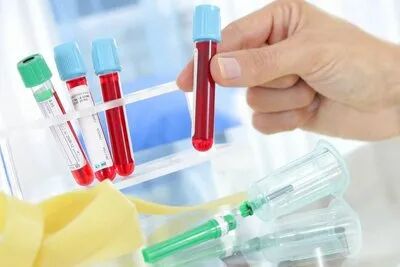 流产还和这个因素有关，备孕的姐妹不能不管！