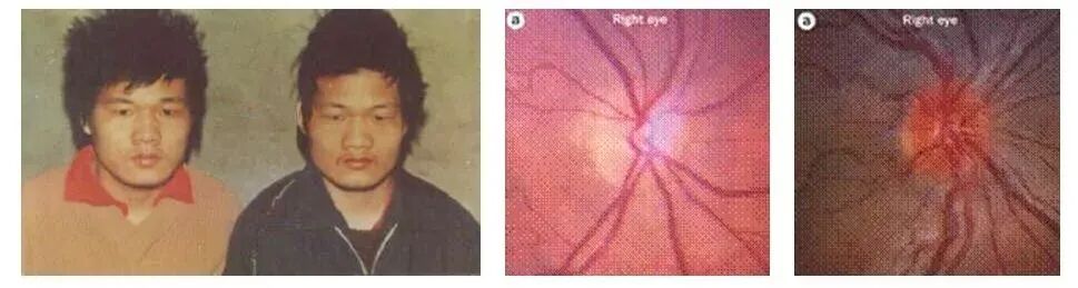 养卵必看：一文讲清改善卵子质量的关键所在！