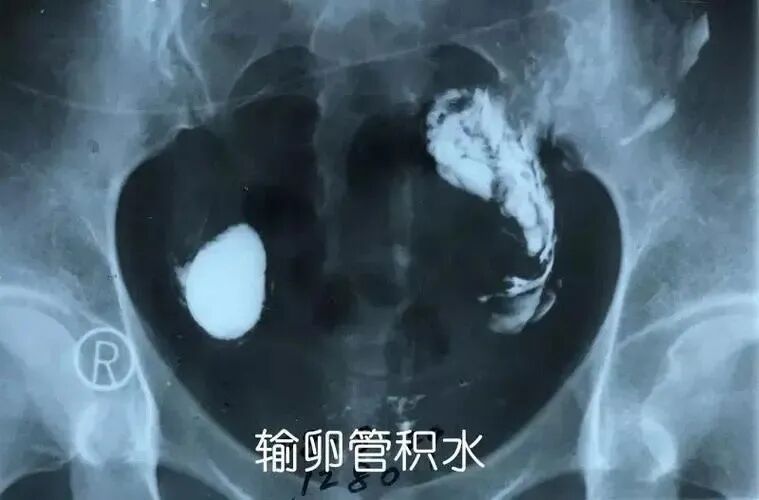 胚胎反复不着床的痛谁懂！该怎么办才好?