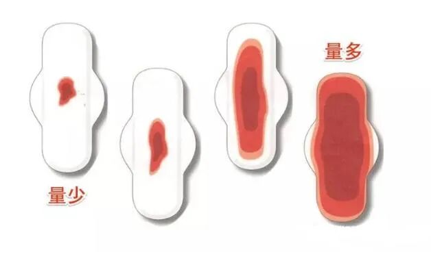 月经变少，是不是卵巢早衰了呢?