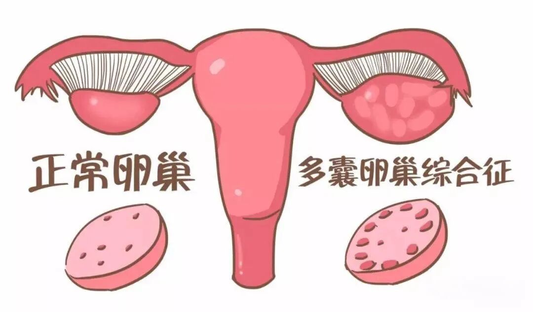 月经变少，是不是卵巢早衰了呢?