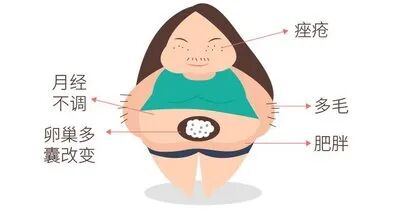 多囊难孕易流产，这六大关键点很重要！