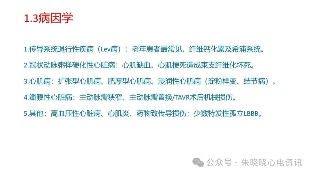 左束支阻滞再认识，实在太全了！