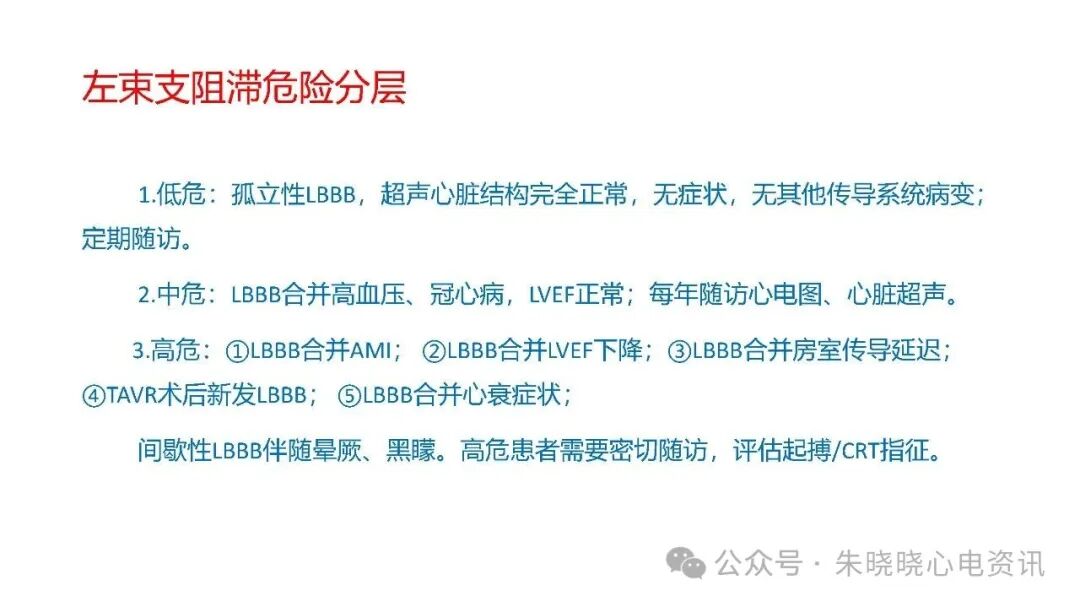 左束支阻滞再认识，实在太全了！
