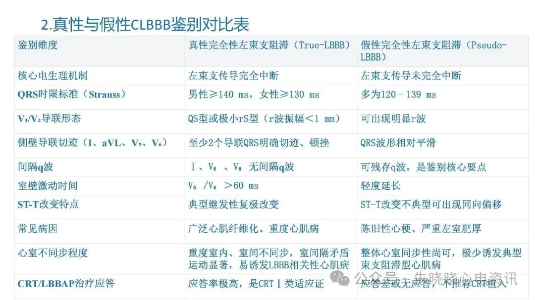 左束支阻滞再认识，实在太全了！