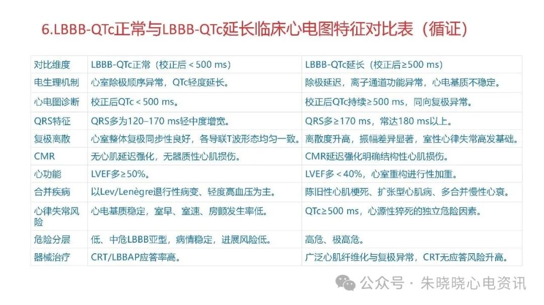 左束支阻滞再认识，实在太全了！