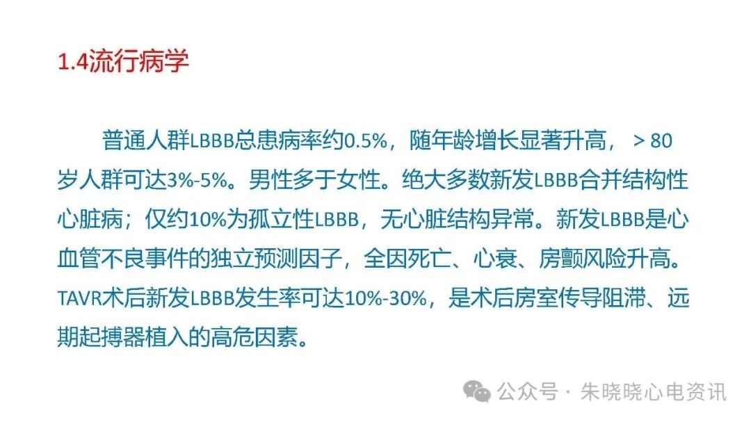 左束支阻滞再认识，实在太全了！