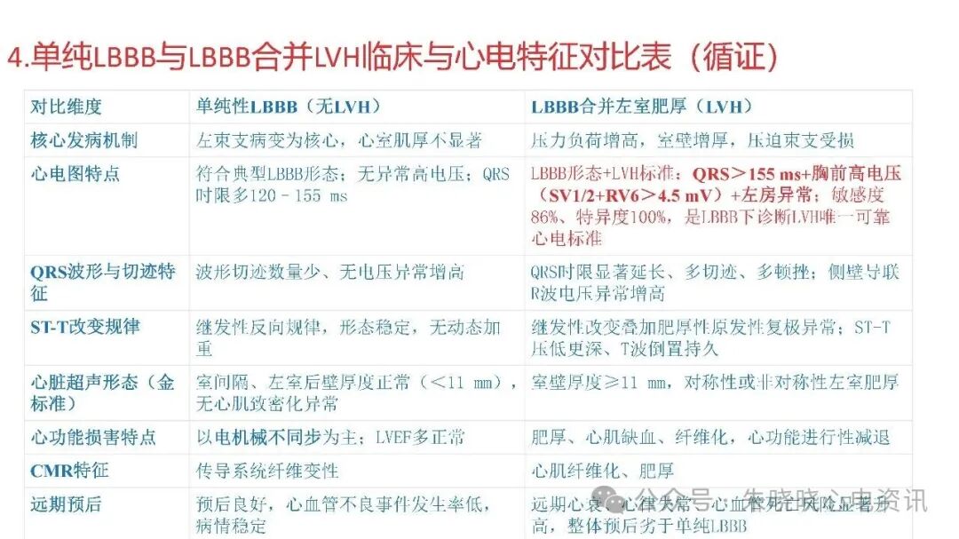 左束支阻滞再认识，实在太全了！