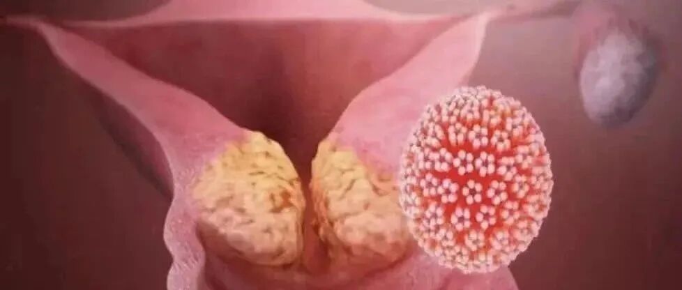 千万别硬撑！这些情况赶紧去肛肠科(图2)