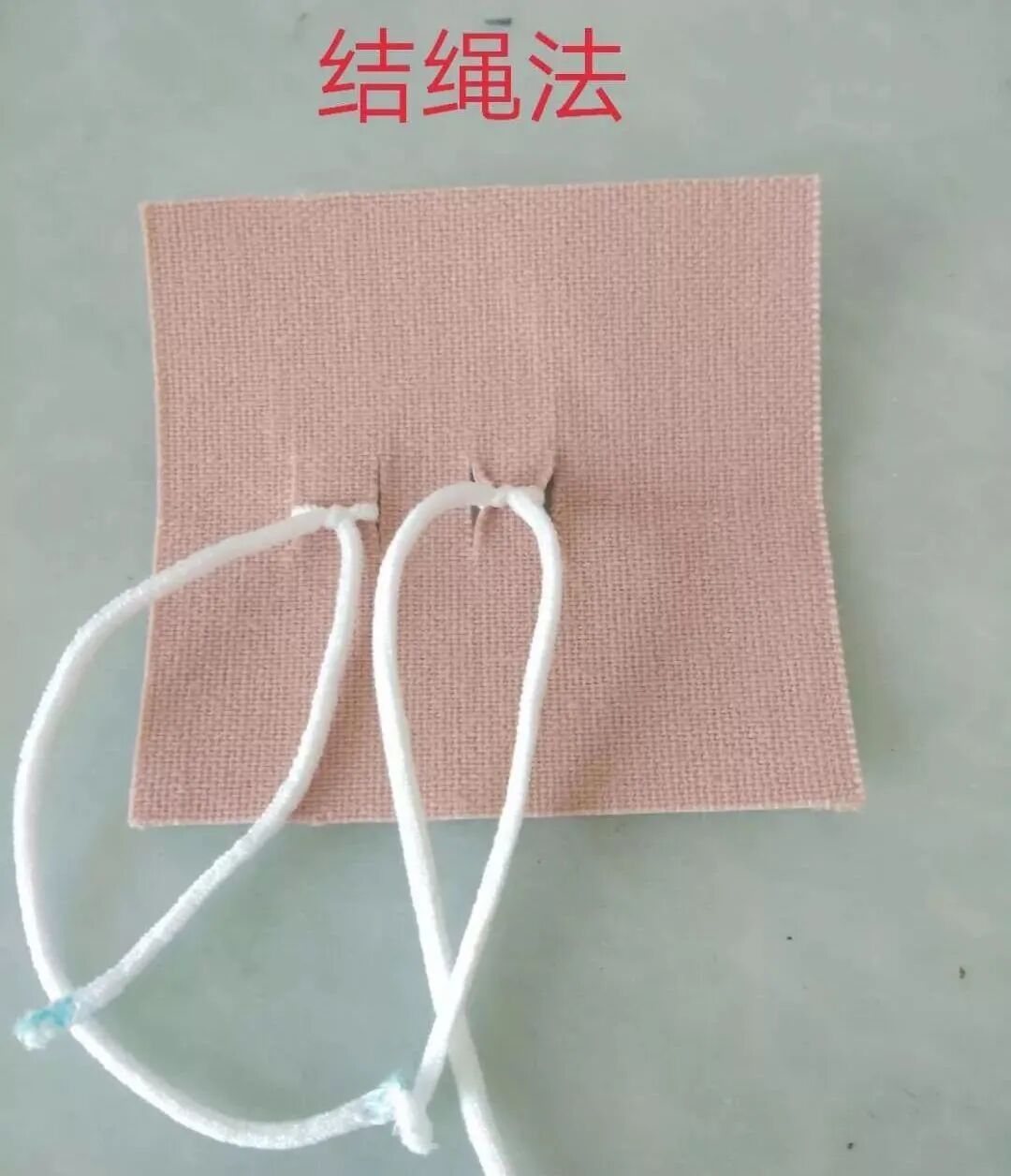 尿管怎么固定学会这7种引流管固定方法，患者术后下床活动不慌张！_https://www.jmylbn.com_新闻资讯_第4张