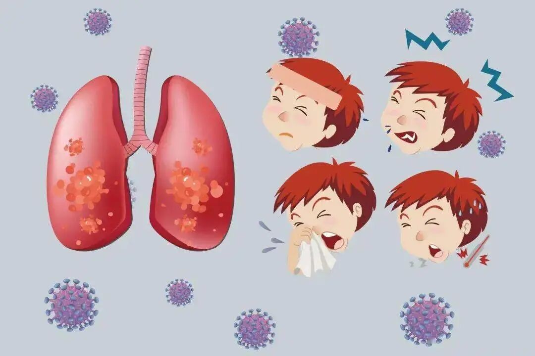 支原体肺炎来势汹汹，除了“阿奇霉素”类药物，中医能做什么？