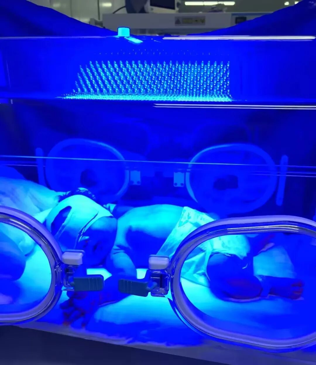 为什么要用光疗纸尿裤日间光疗，为“黄疸宝宝”保驾护航_https://www.jmylbn.com_新闻资讯_第6张