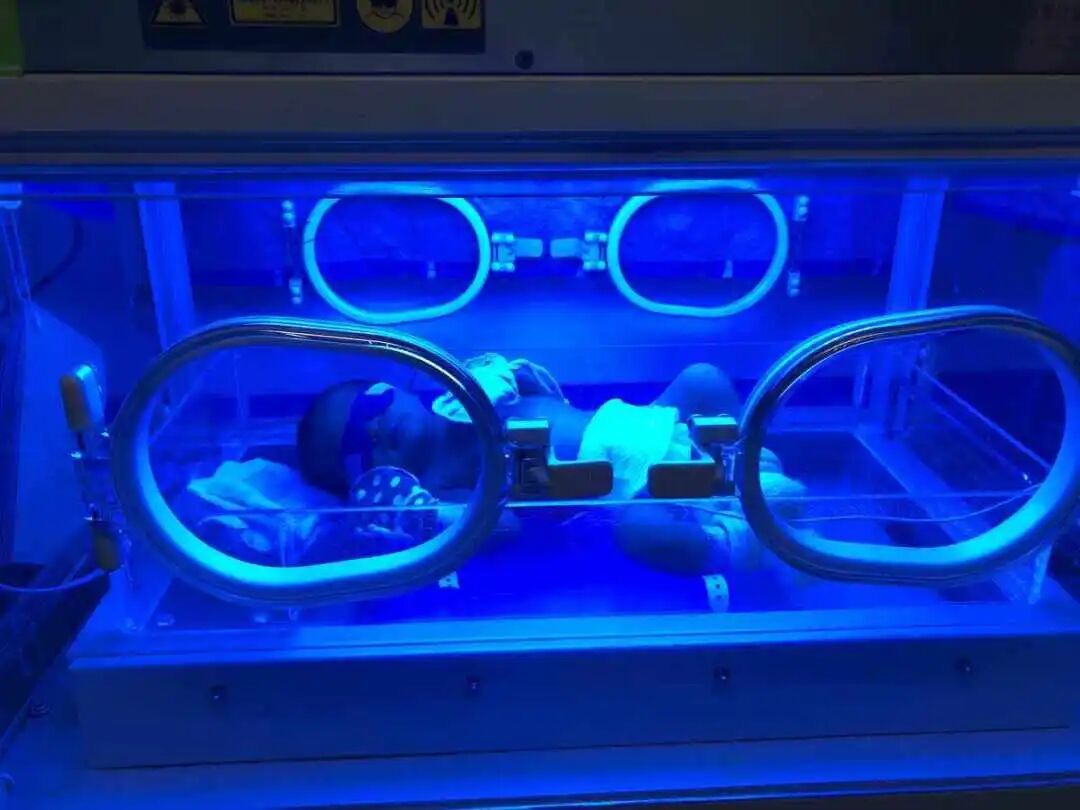 为什么要用光疗纸尿裤日间光疗，为“黄疸宝宝”保驾护航_https://www.jmylbn.com_新闻资讯_第24张