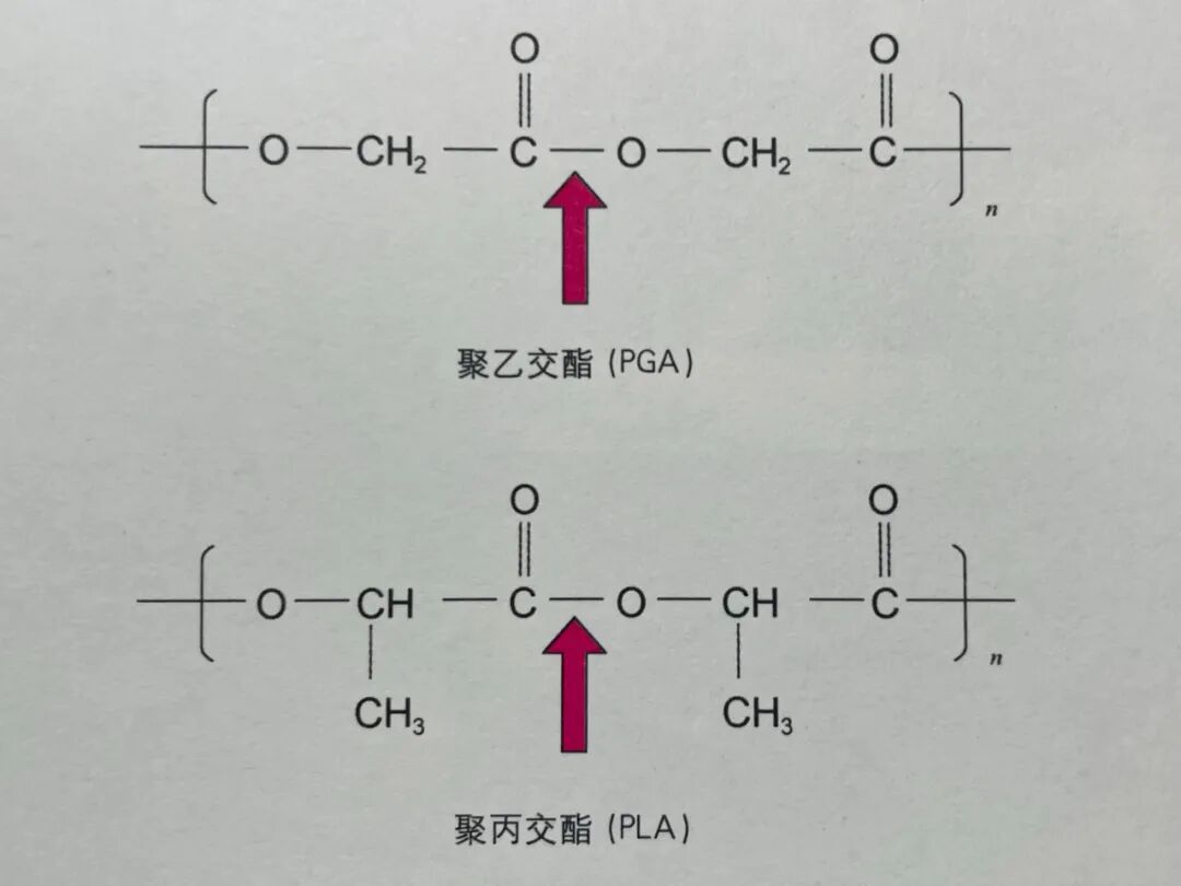 手术缝合线是什么材料防弹衣是用什么材料做成的？尿不湿为什么能不湿？为什么外科手术的缝合线会被人体吸收？_https://www.jmylbn.com_新闻资讯_第5张