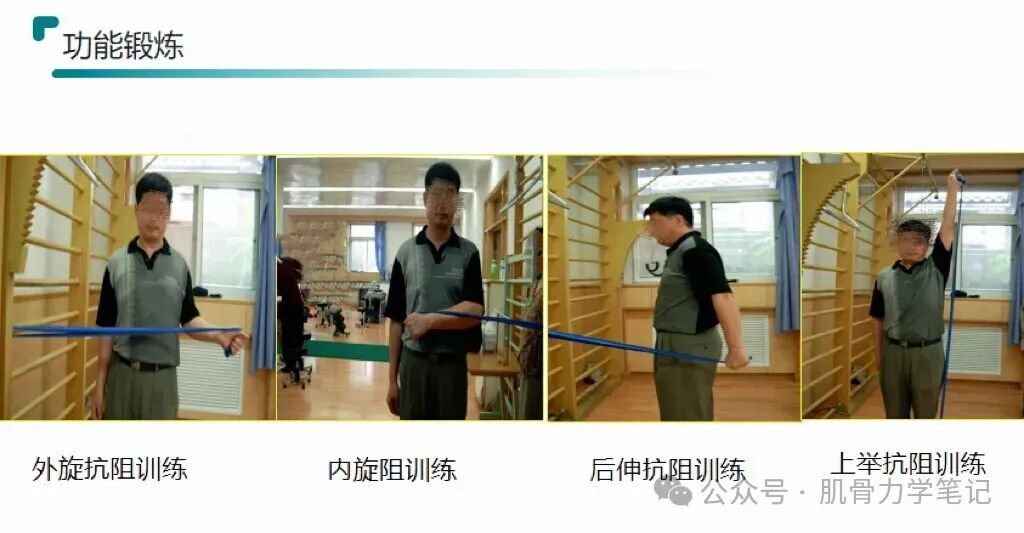 中频为什么能镇痛肩周炎（冻结肩）的综合诊疗思路_https://www.jmylbn.com_新闻资讯_第18张