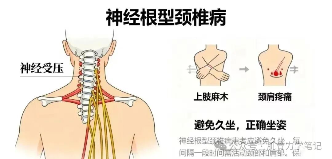 中频为什么能镇痛肩周炎（冻结肩）的综合诊疗思路_https://www.jmylbn.com_新闻资讯_第14张