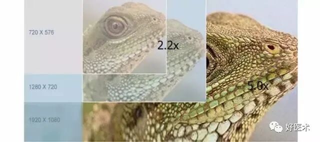 关节镜配套哪些关节镜技术速成诀窍_https://www.jmylbn.com_新闻资讯_第26张